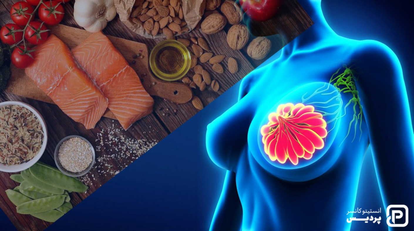 چگونه تغذیه سالم به پیشگیری از سرطان سینه کمک می کند