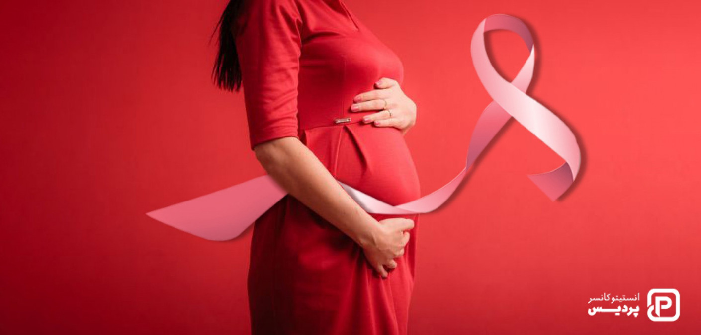 درمان سرطان سینه در دوران بارداری به چه صورت است؟