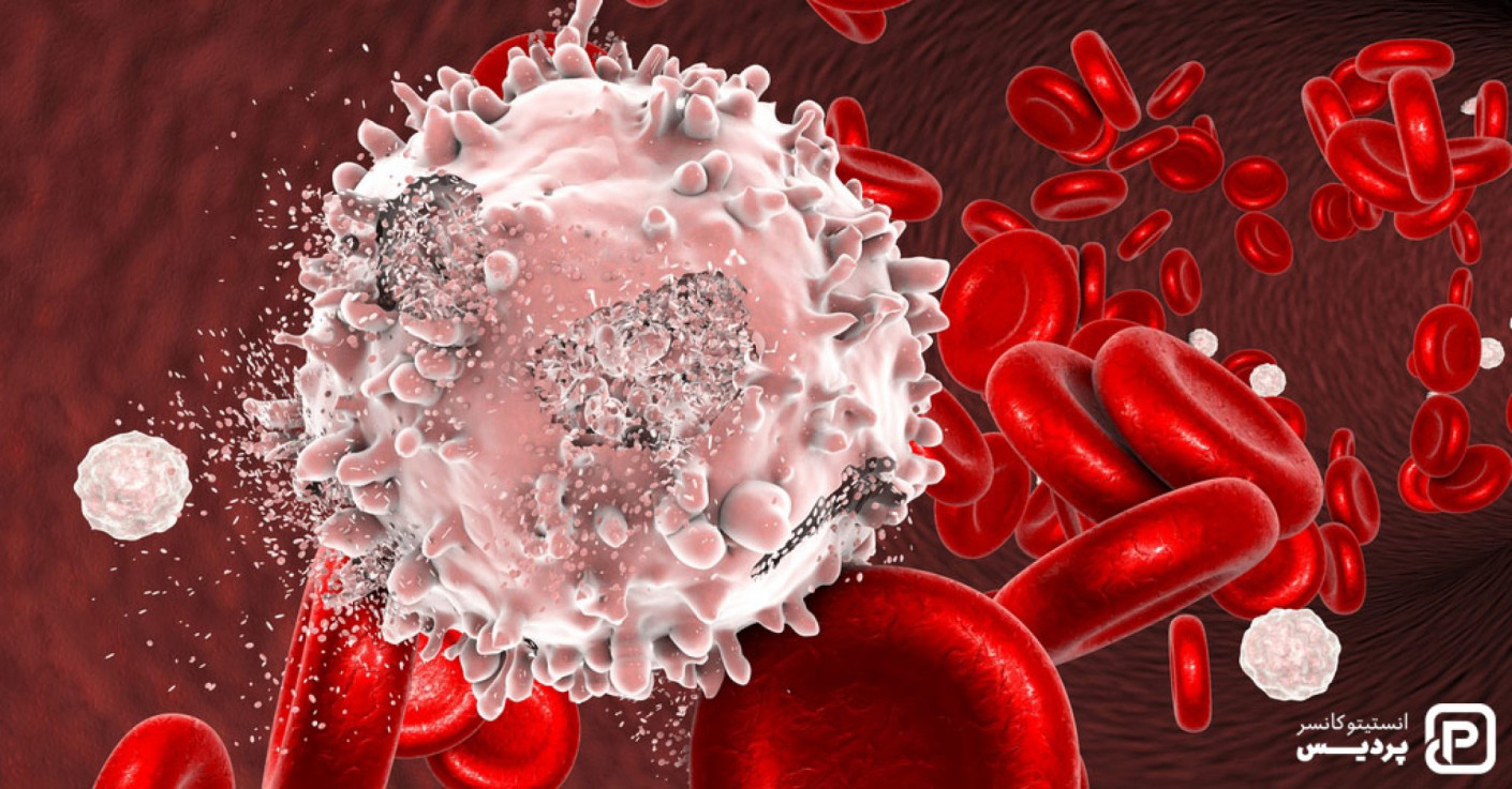 سرطان خون چیست و راههای تشخیص و درمان آن کدامند؟