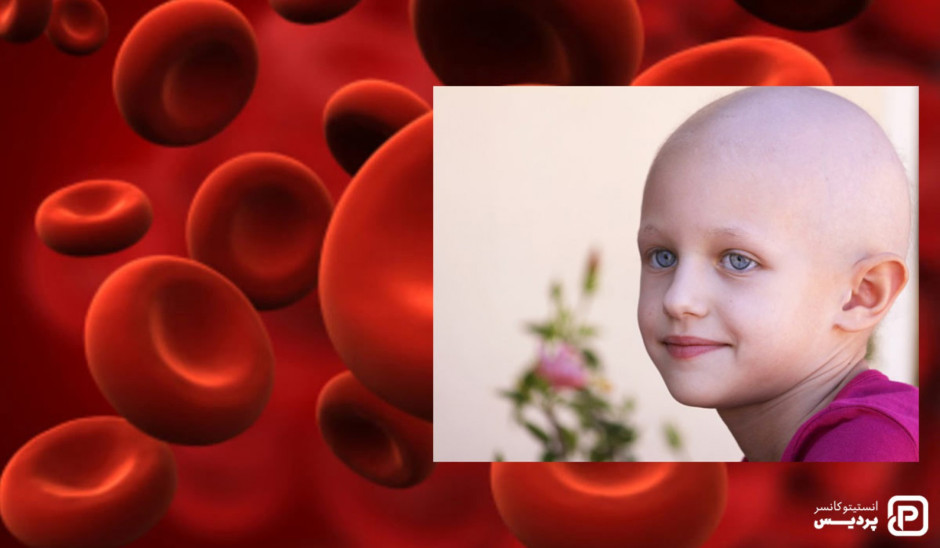 چگونه می توان از سرطان خون در کودکان پیشگیری کرد