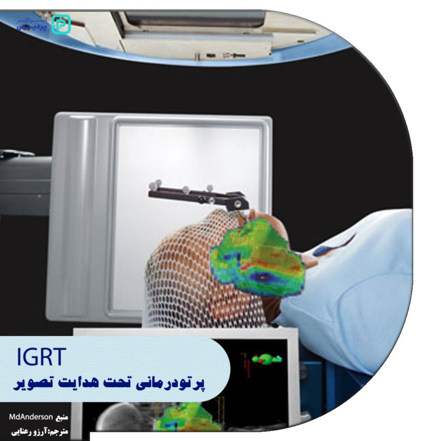 پرتو درمانی تحت هدایت تصویر IGRT چه کاربردی دارد