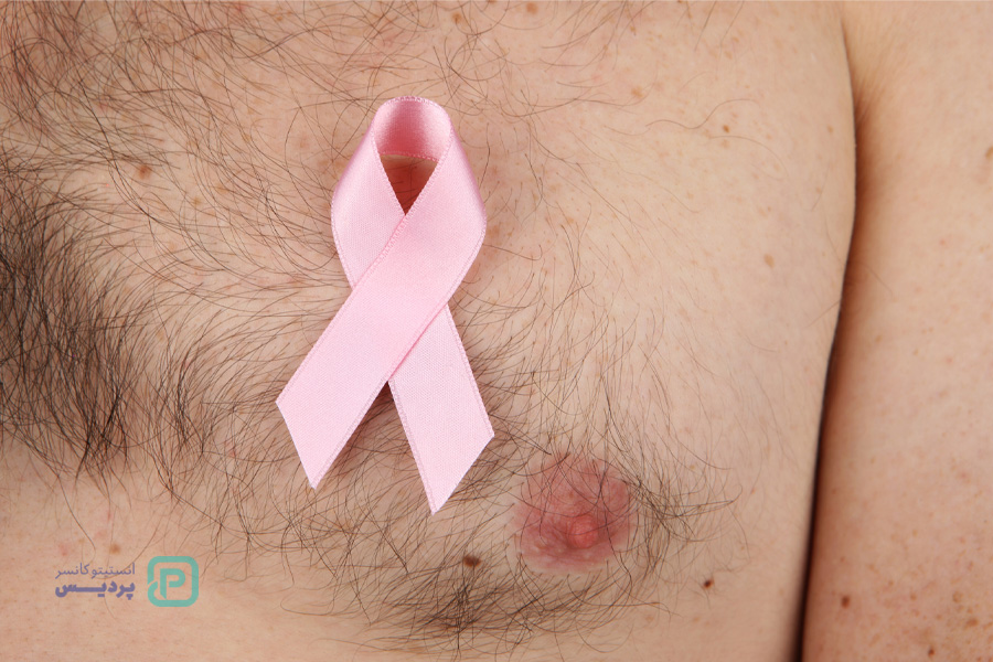 درمان هدفمند برای درمان سرطان سینه مردان