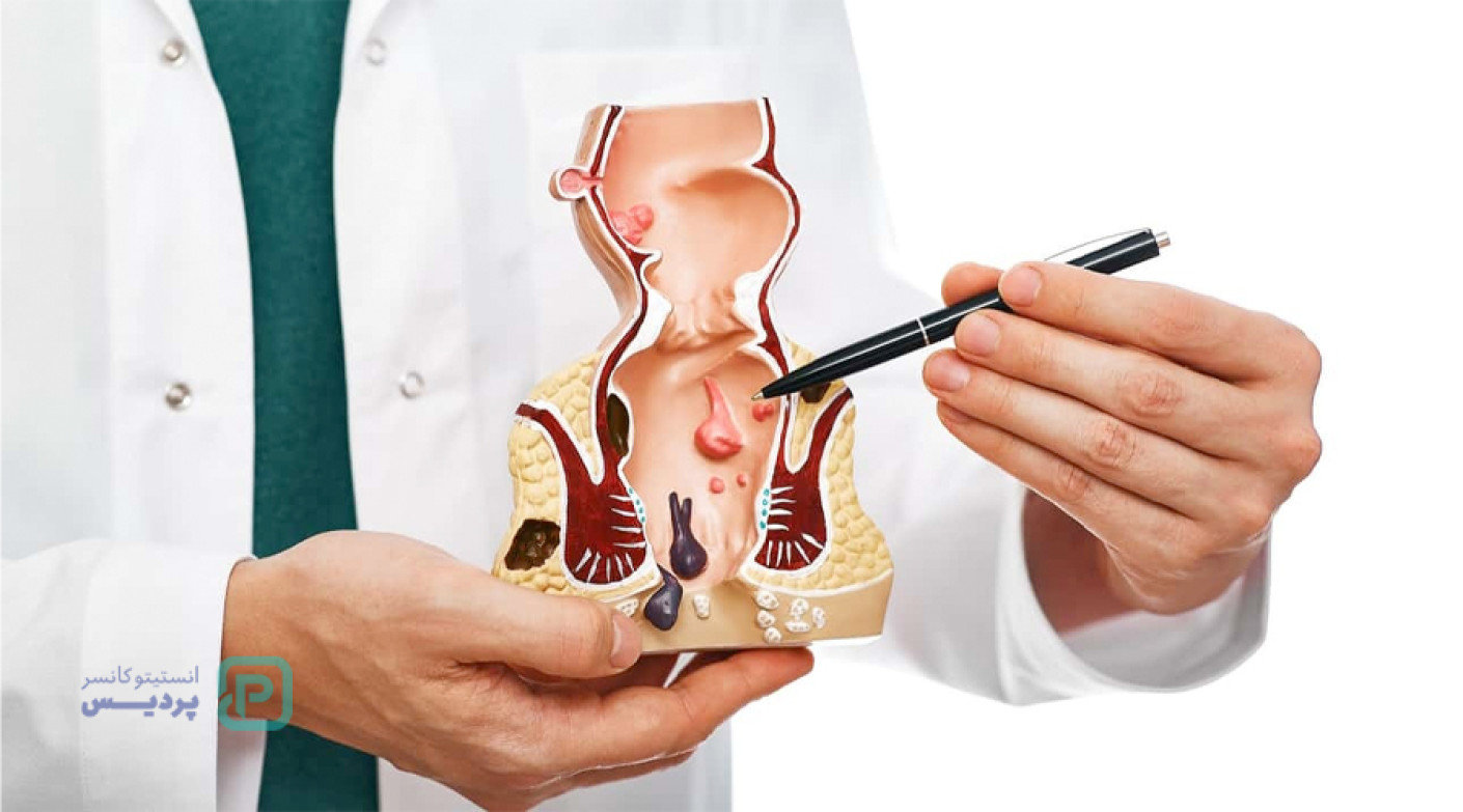 علائم سرطان مقعد چیست؟ تشخیص و درمان