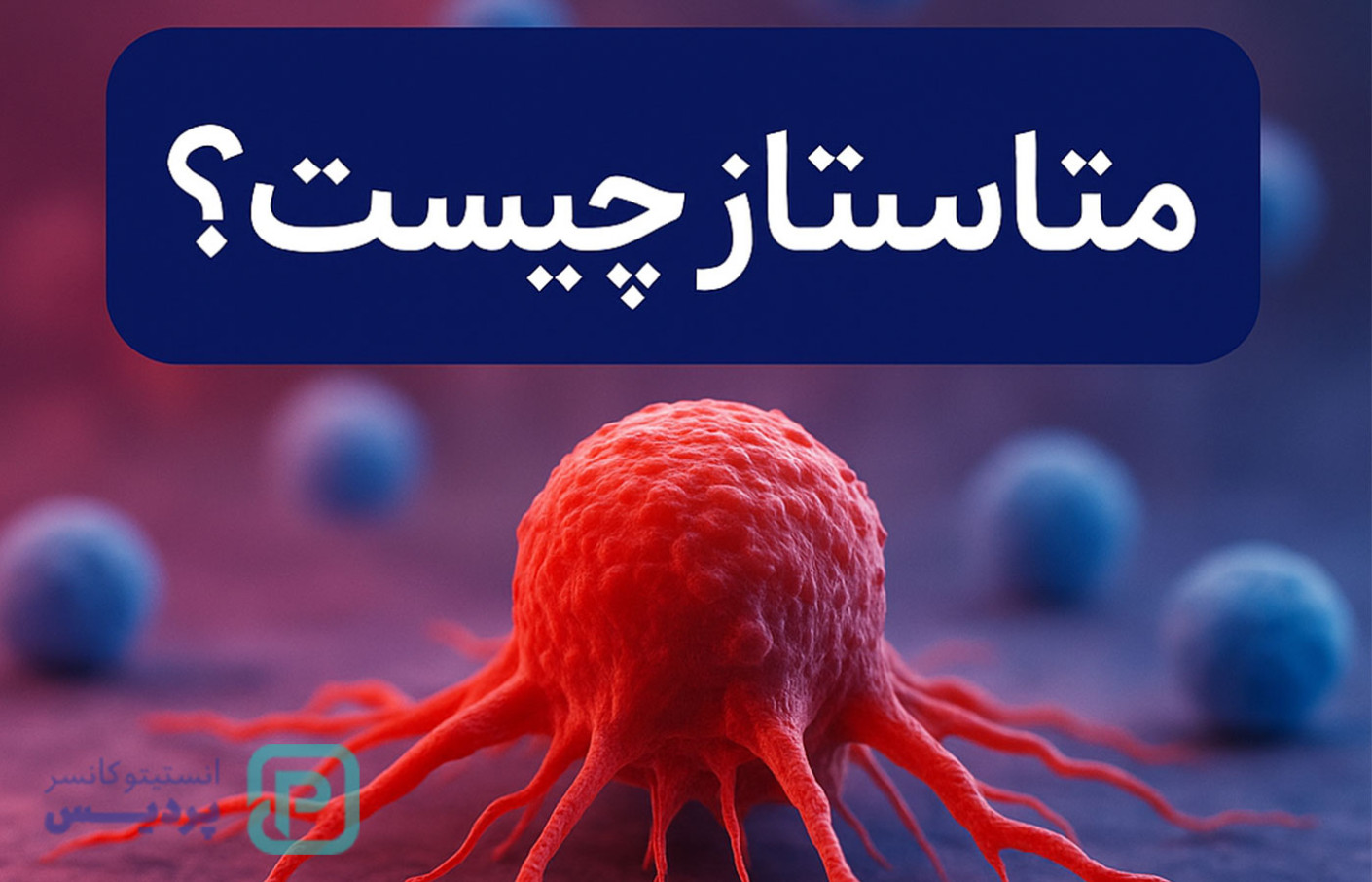 متاستاز چیست؟ همه چیز درباره گسترش سرطان به زبان ساده