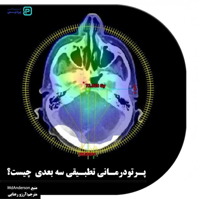 پرتو درمانی تطبیقی سه بعدی چیست؟