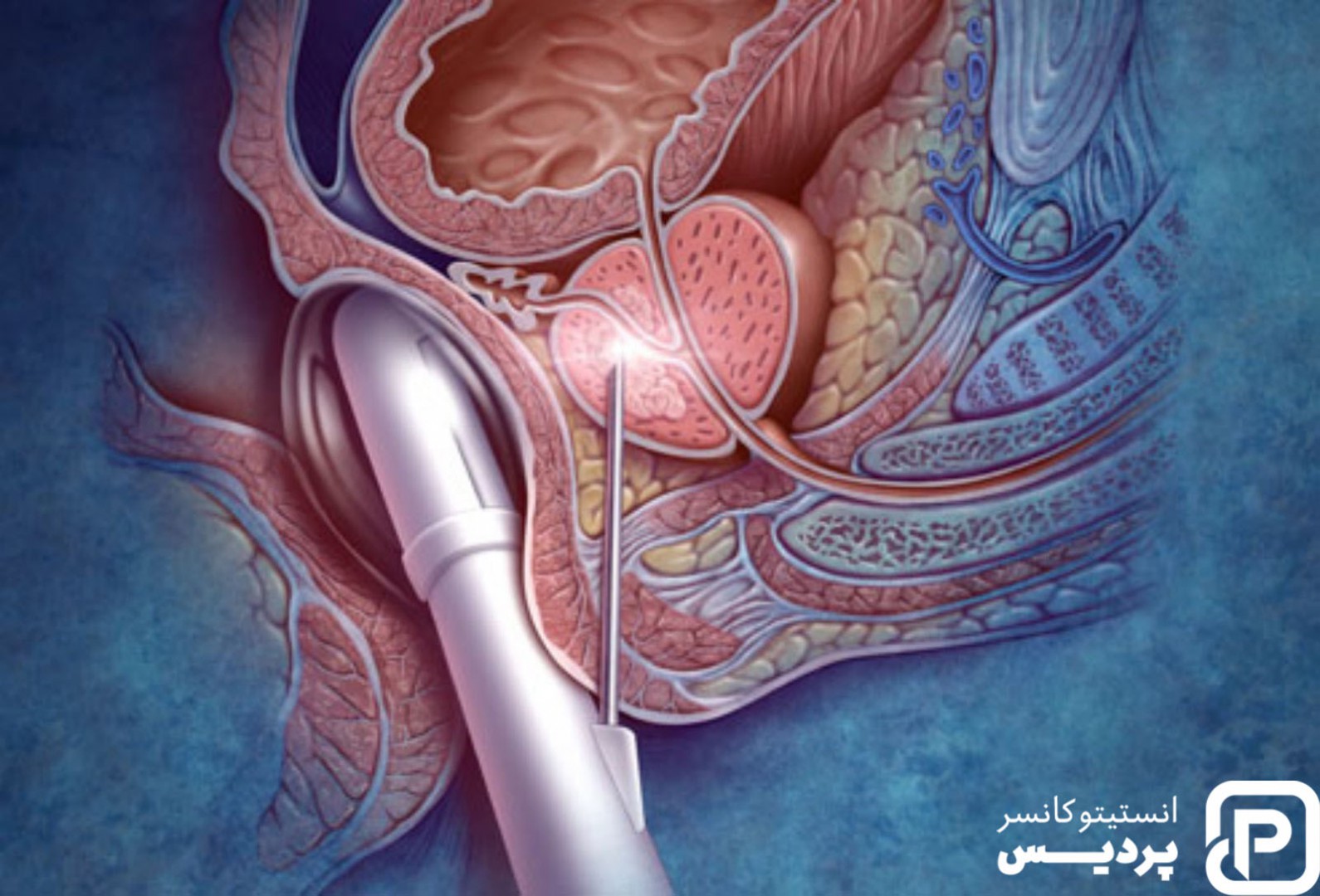 Простата и предстательная железа