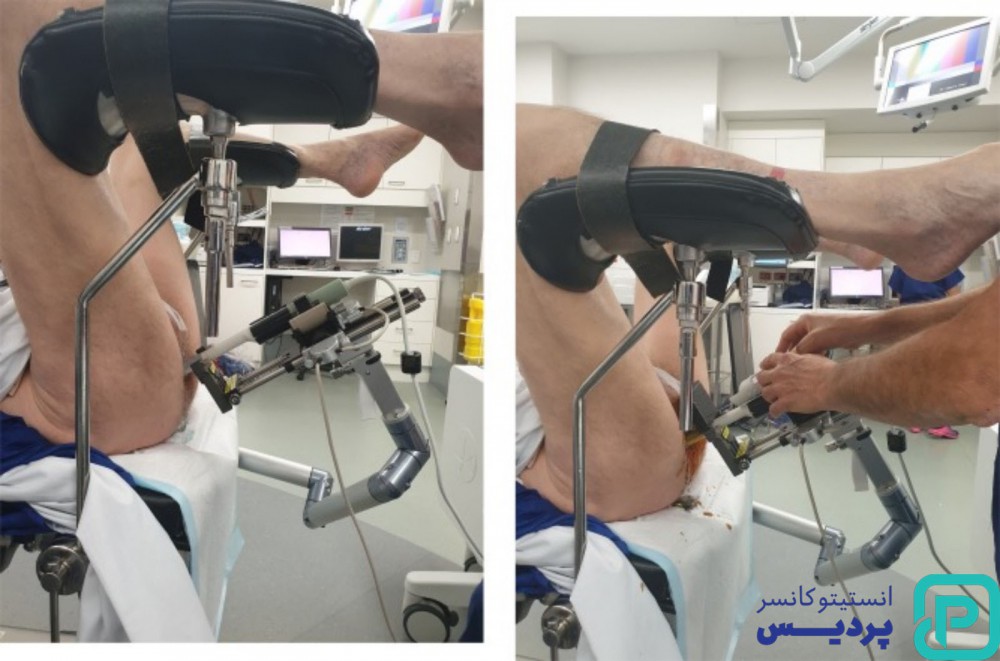 معاینه پروستات چگونه انجام میشود؟