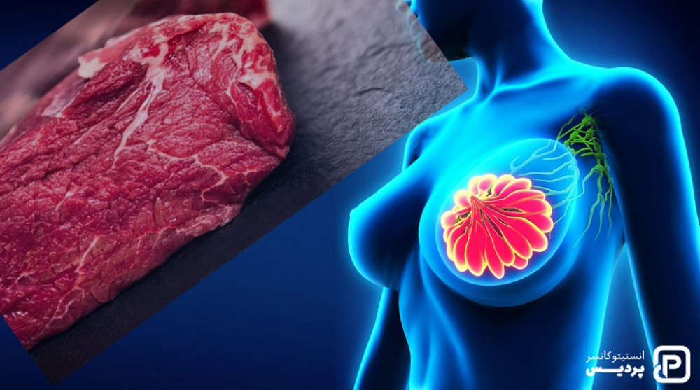مصرف گوشت قرمز می تواند با خطر ابتلا به سرطان سینه ارتباط داشته باشد