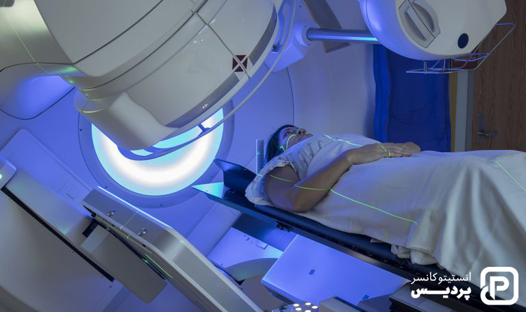 درمان سرطان روده با رادیوتراپی