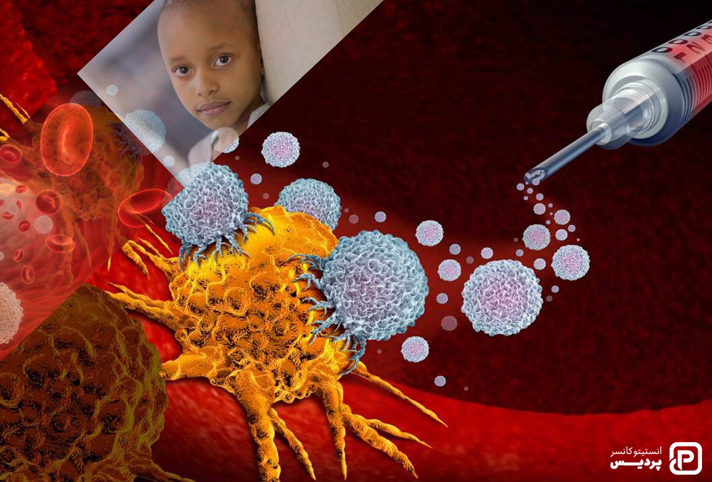 ایمونوتراپی برای درمان سرطان خون در کودکان