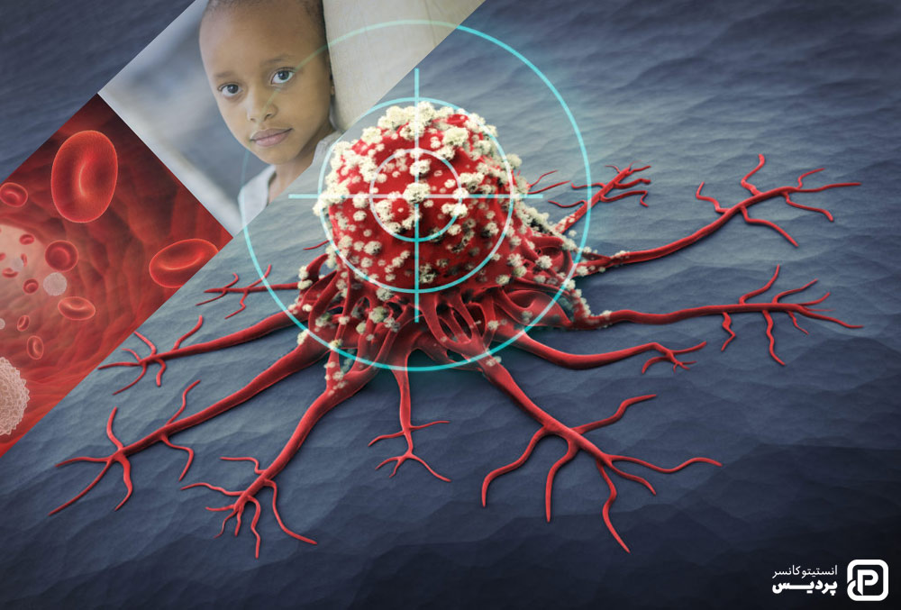 درمان هدفمند و درمان سرطان خون در کودکان