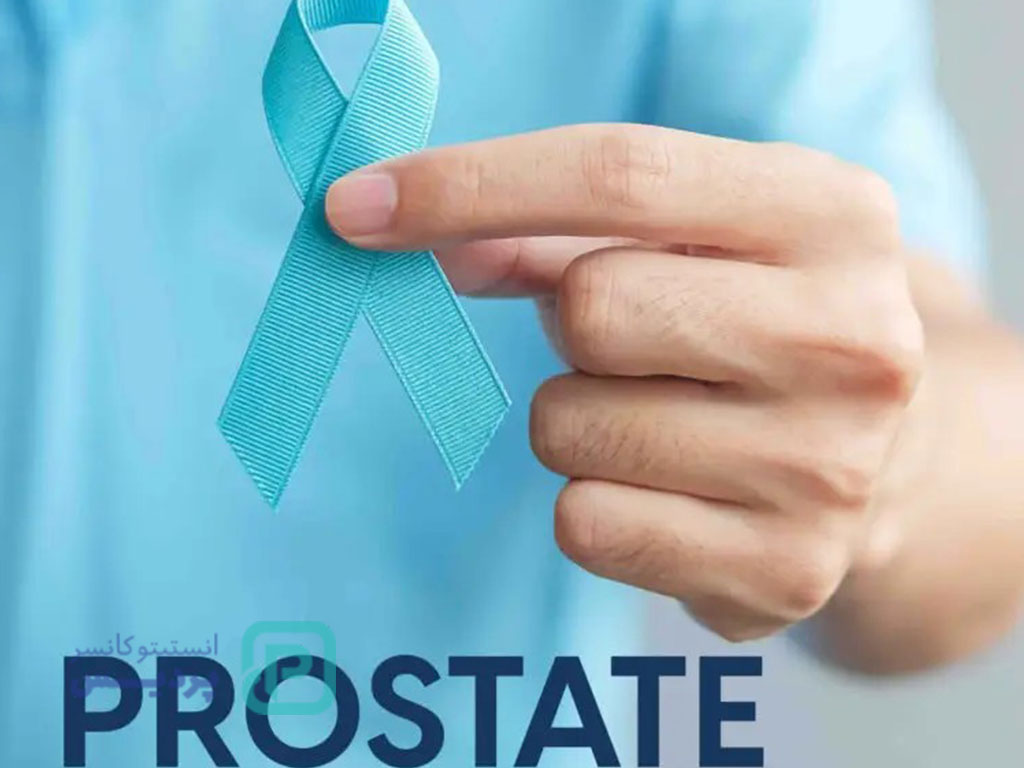 سرطان پروستات، نشانه ها و راههای تشخیص و درمان آن 2 سرطان پروستات-1