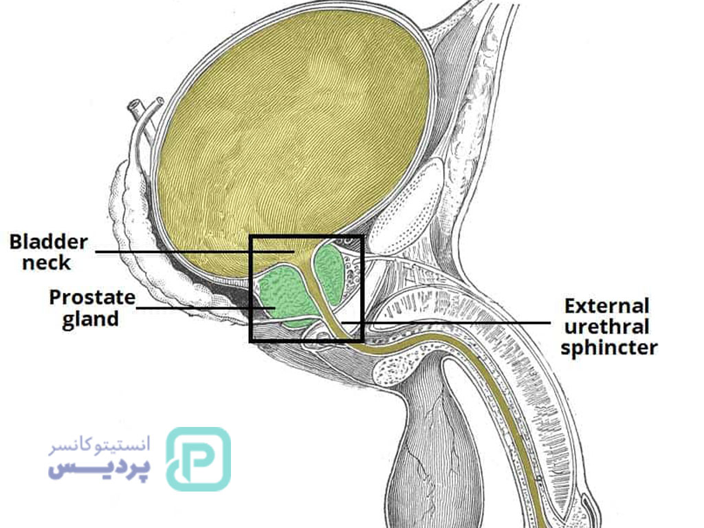 سرطان پروستات، نشانه ها و راههای تشخیص و درمان آن 3 سرطان پروستات-2
