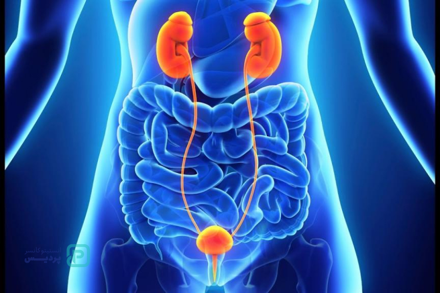 انواع سرطان: آشنایی با علائم، روشهای تشخیص و درمان 8 سرطان مثانه