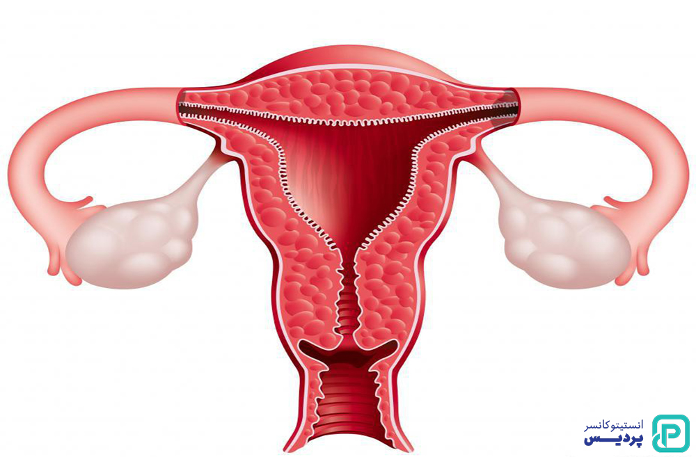 تشخیص سرطان دهانه رحم چگونه انجام می شود