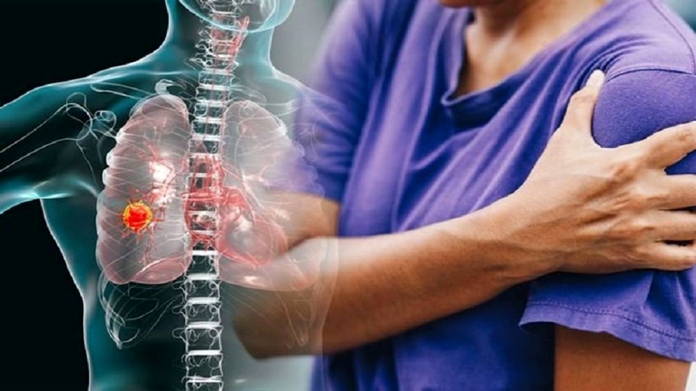 مواجهه با سرطان ریه