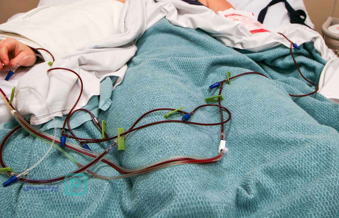 پیوند مغز استخوان: هرآنچه باید بدانید 2 پیوند مغز استخوان: هرآنچه باید بدانید - 2