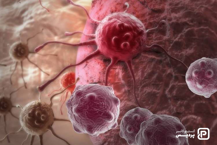 مرحله بندی سرطان