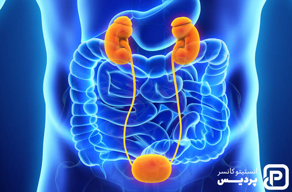 تشخیص سرطان مثانه