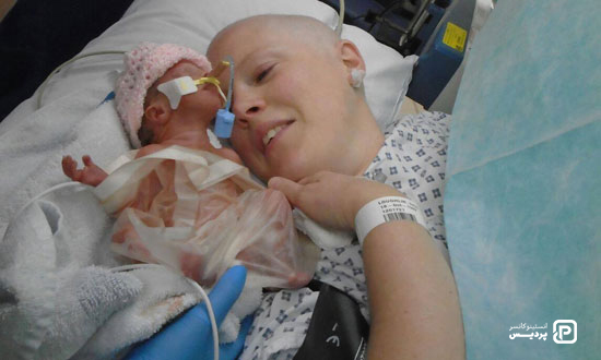 درمان سرطان سینه در دوران بارداری به چه صورت است؟ 3 سرطان پستان و حاملگی