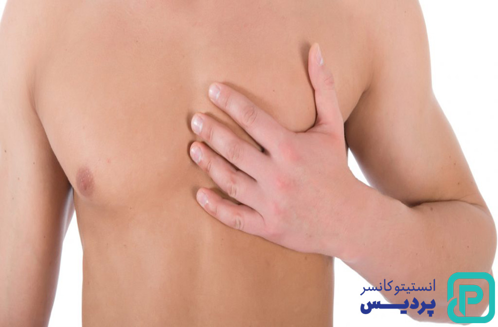 شیمی درمانی سرطان سینه مردان 7 درمان سرطان سینه مران چگونه است