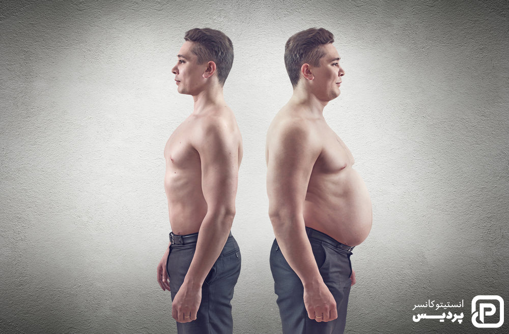 آیا اضافه وزن بر ابتلا به سرطان تاثیر می گذارد؟