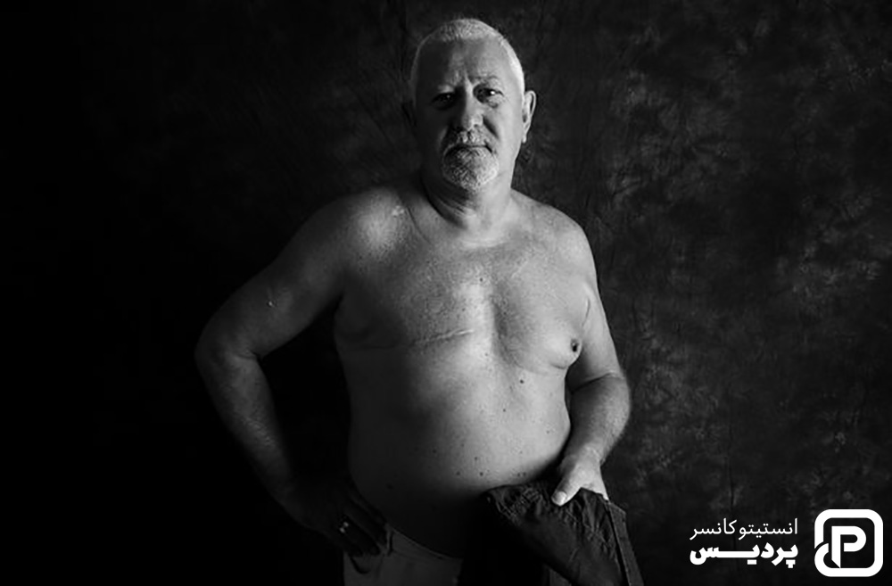 شیمی درمانی سرطان سینه مردان 6 شیمی درمانی برای درمان سرطان سینه مردان