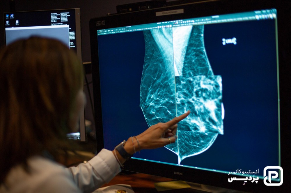 تشخیص سرطان پستان