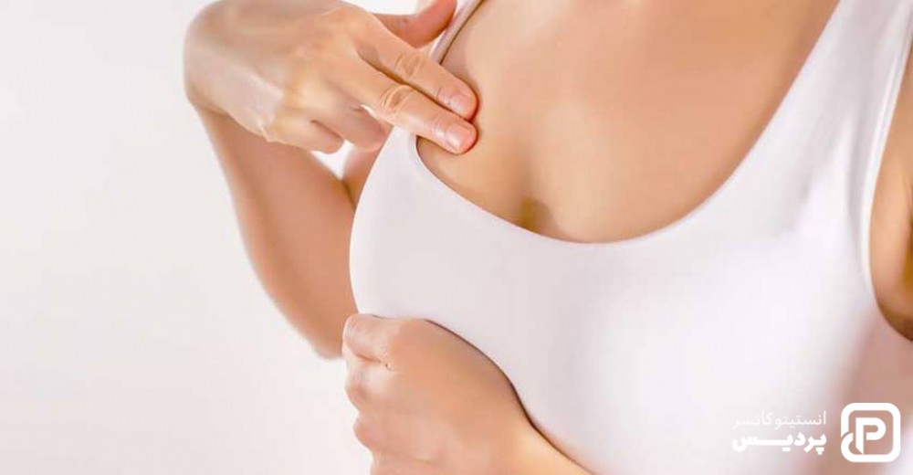 چگونه خطر ابتلا به سرطان سینه را کاهش دهیم؟ 2 پیشگیری از سرطان سینه