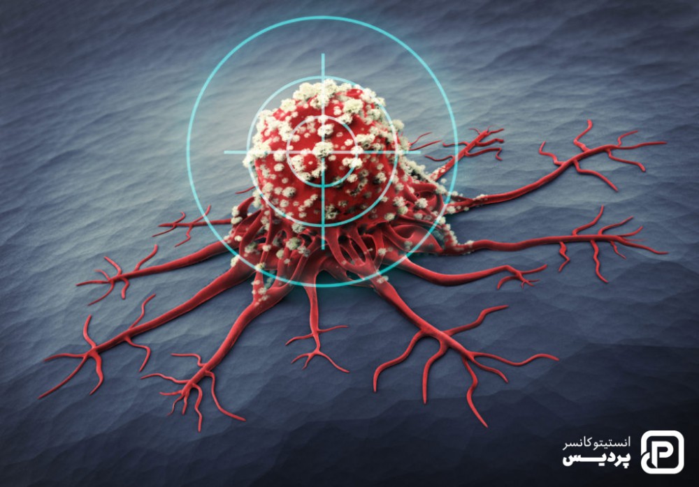 درمان هدفمند سرطان سینه