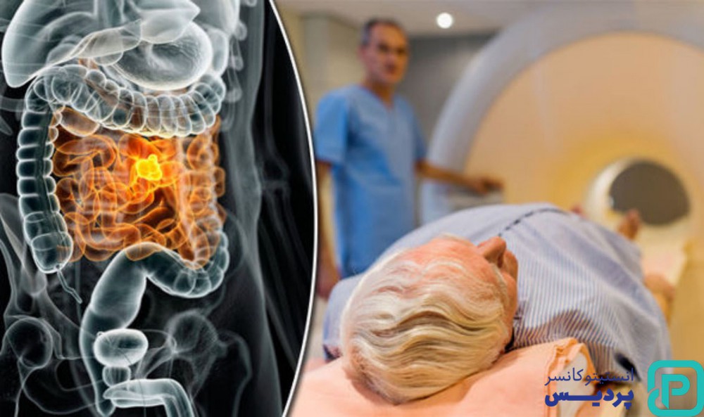  سرطان روده چگونه تشخیص داده می شود؟