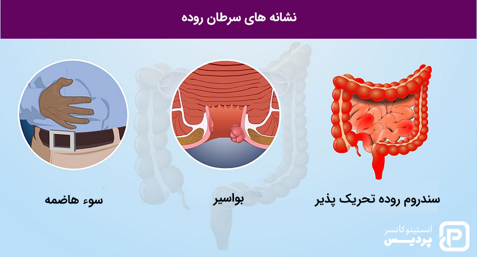 علائم سیستمیک سرطان روده