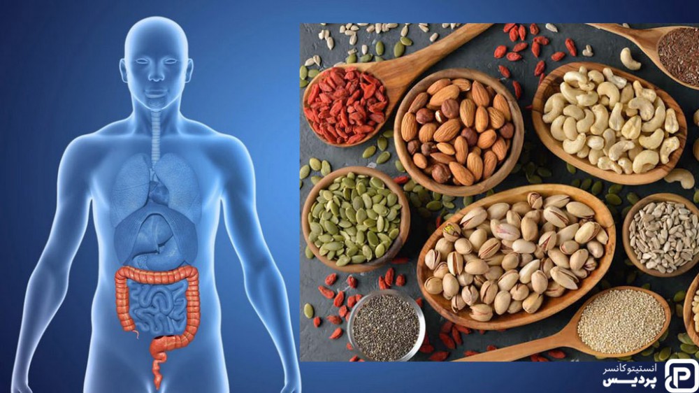 خوردن آجیل ها می تواند در رژیم غذایی مناسب سرطان روده موثر واقع شود