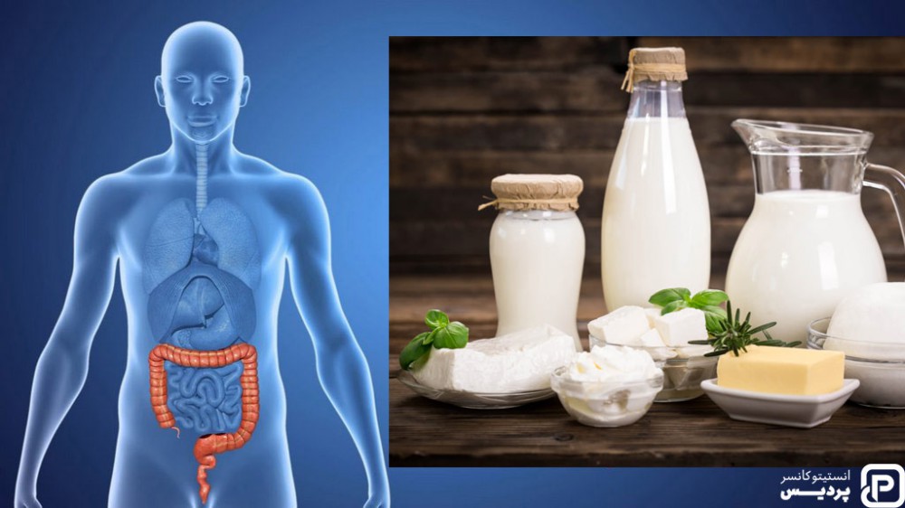 مصرف لبنیات کم چرب می تواند در رژیم غذایی سرطان روده بزرگ موثر واقع شود