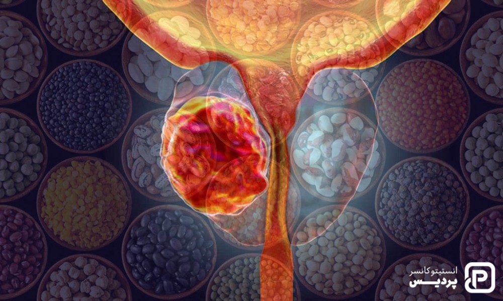 مصرف حبوبات بر سرطان پروستات اثر مثبت دارد.