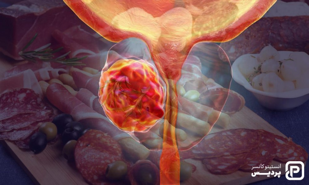 مصرف زیاد گوشت قرمز می تواند اثر منفی بر سرطان پروستات داشته باشد