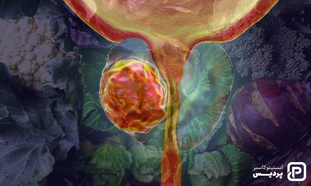 سبزیجات چلیپایی مانند گل کلم، کلم بروکلی و .. می تواند برای سرطان پروستات مفید باشد