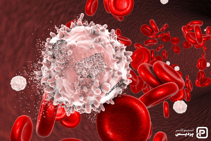 تشخیص سرطان خون