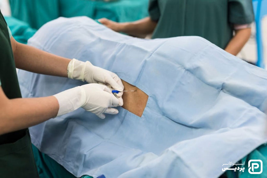 بیوپسی مغز استخوان