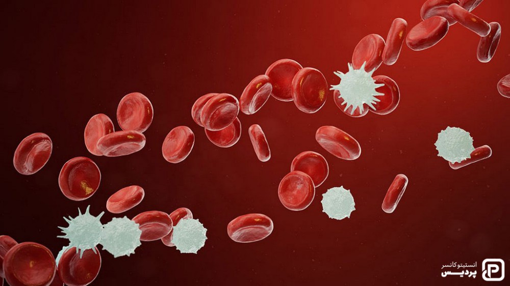 مرحله بندی سرطان خون حاد لنفوسیتی