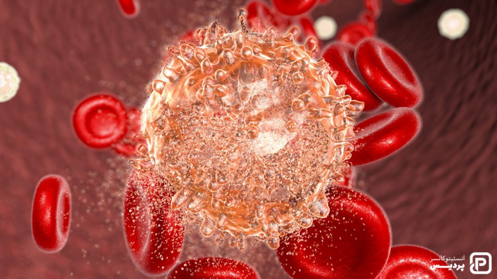 مراحل لوسمی لنفوسیتی مزمن