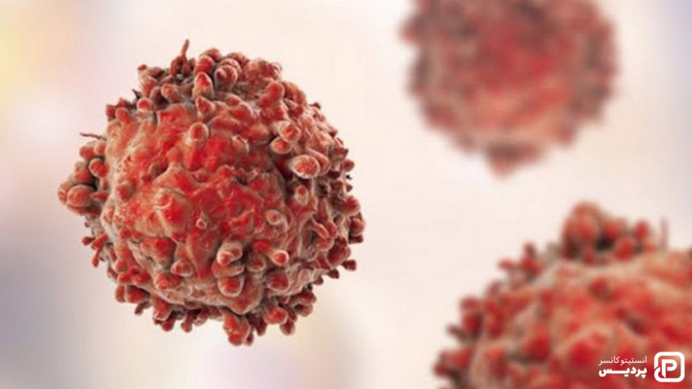 مراحل لوسمی میلوئیدی مزمن