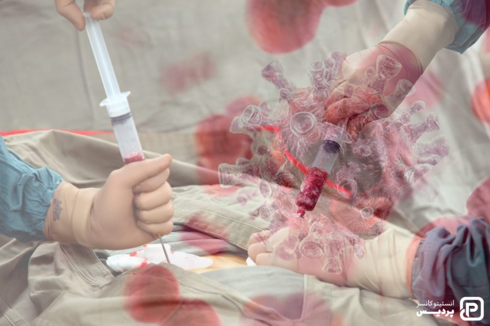 پیوند سلول های بنیادی