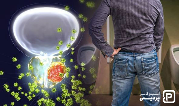 چه عواملی خطر ابتلا به سرطان پروستات را افزایش می دهند