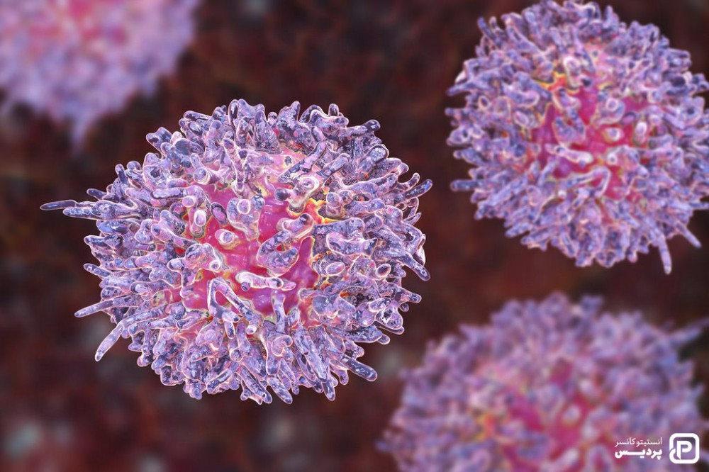 لوسمی سلول مویی 