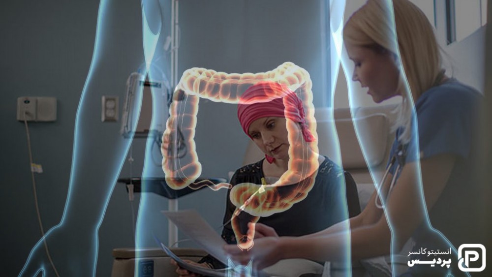 شیمی درمانی چگونه به درمان سرطان روده بزرگ کمک می کند؟ 2 شیمی درمانی برای درمان سرطان روده ممکن است قبل یا بعد جراحی انجام شود