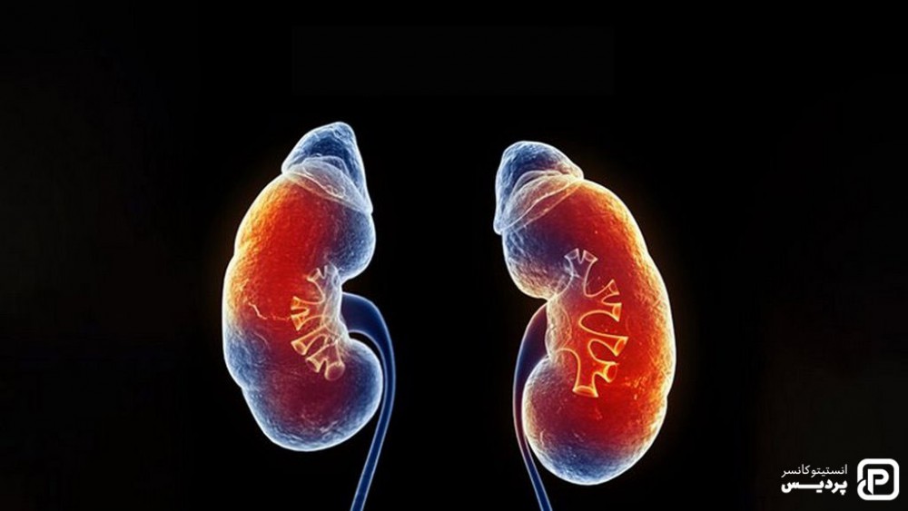 تومور ویلمز یکی از انواع سرطان در کودکان می باشد