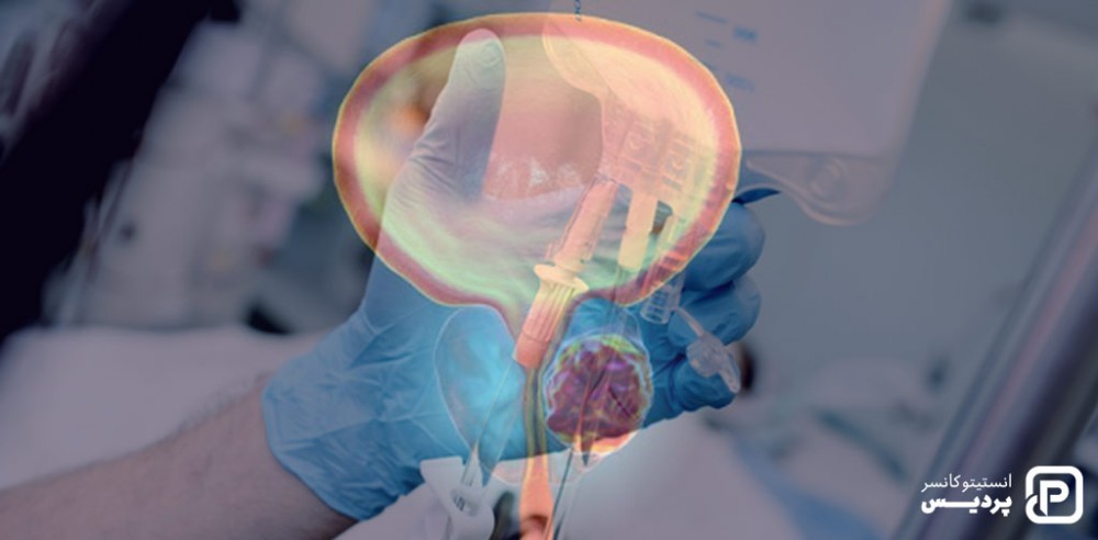 داکتاسل اولین داروی شیمی ردمانی است که مرود ساتفاده قرار می گیرد