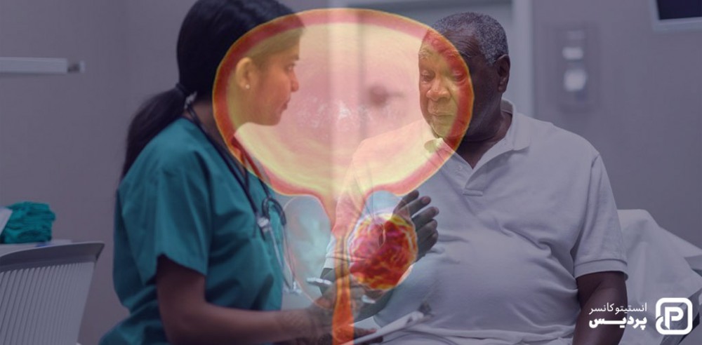 در مورد عوارض جانبی شیمی درمانی برای درمان سرطان پروستات با پزشکتان مشورت نمایید