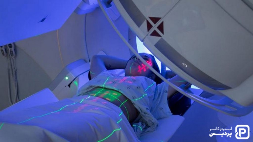 رادیوتراپی شامل سه نوع خارجی، داخلی و سیستمیک می باشد